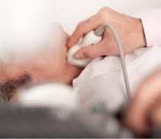 Carotid Stenting