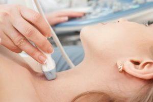 Carotid Ultrasound