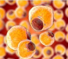 Advanced Lipid Insulin