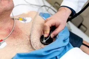 EKG