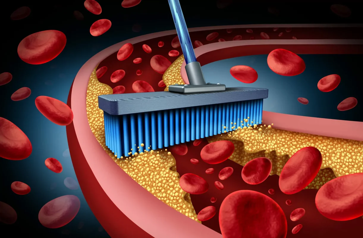 medical-therapies-in-plaque-reversal